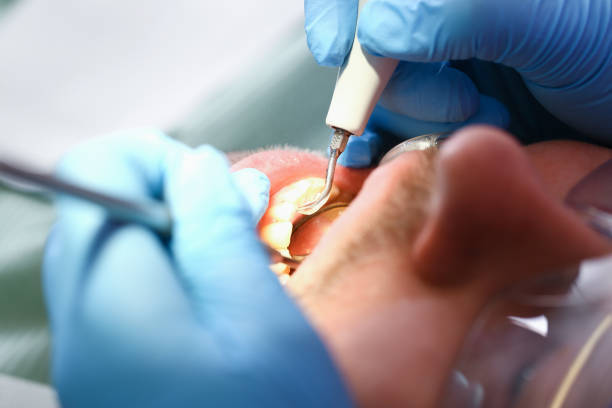 Best Emergency Gum Pain Relief  in Bolindale, OH